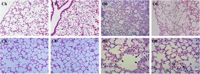 Aerobic Exercise Improves Pulmonary Fibrosis by Improving Insulin Resistance and Inflammation in Obese Mice